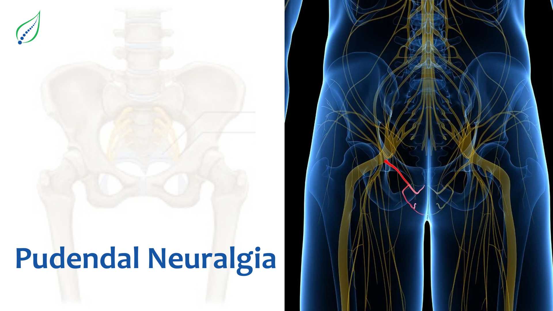 Pudendal Neuralgia : Causes, Symptoms and Treatment